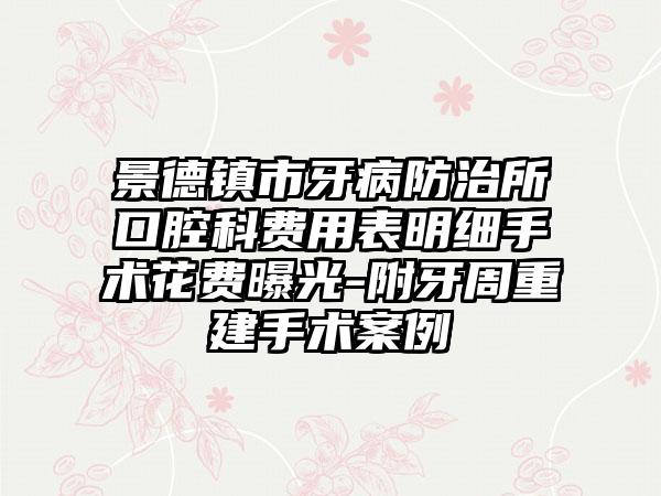 景德镇市牙病防治所口腔科费用表明细手术花费曝光-附牙周重建手术案例