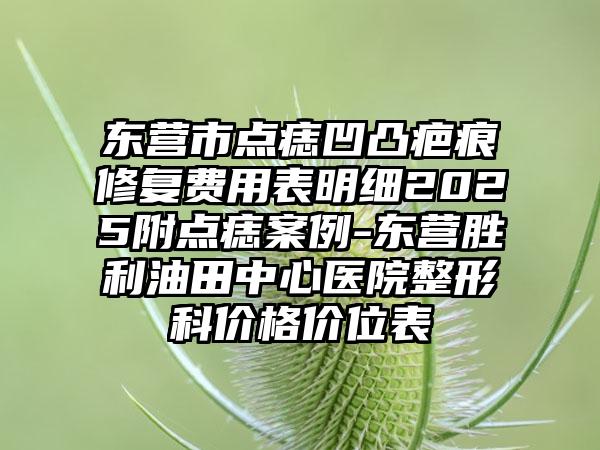 东营市点痣凹凸疤痕修复费用表明细2025附点痣案例-东营胜利油田中心医院整形科价格价位表
