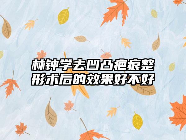 林钟学去凹凸疤痕整形术后的效果好不好