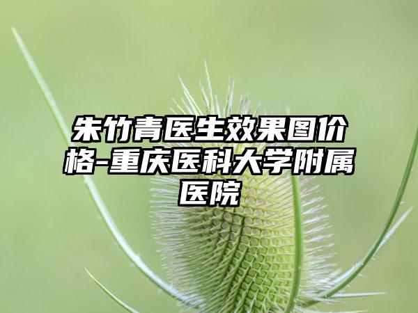 朱竹青医生效果图价格-重庆医科大学附属医院