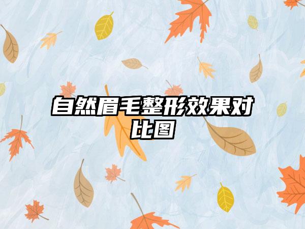 自然眉毛整形效果对比图