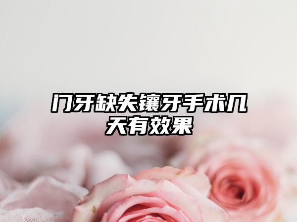 门牙缺失镶牙手术几天有效果