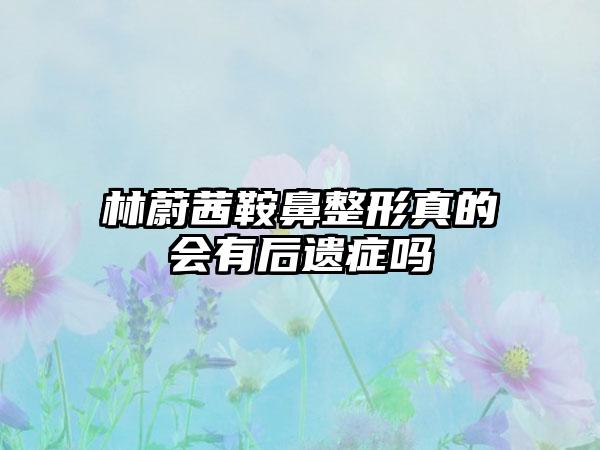 林蔚茜鞍鼻整形真的会有后遗症吗