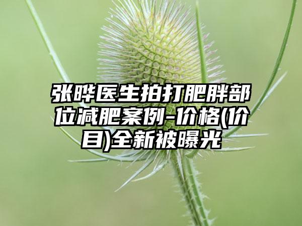 张晔医生拍打肥胖部位减肥案例-价格(价目)全新被曝光