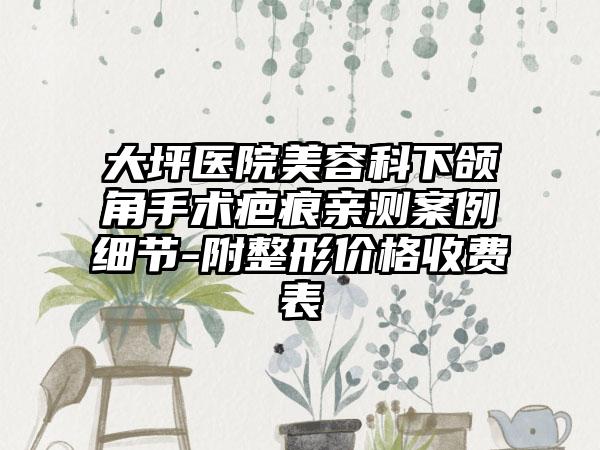 大坪医院美容科下颌角手术疤痕亲测案例细节-附整形价格收费表
